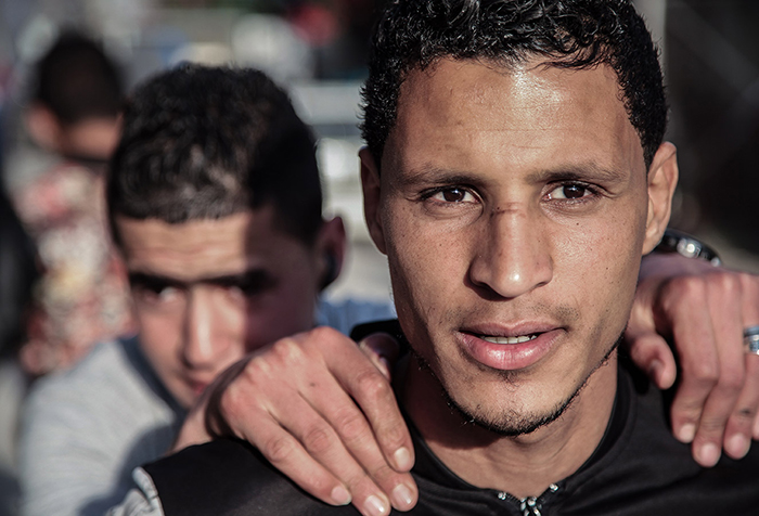 A young man places his hands on the shoulders of another in front. The young man in the front has a nose injury